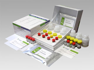 抗甲状腺球蛋白抗体定量检测试剂盒(化学发光法)