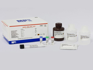 抗可提取性核抗原(ENA)抗体检测试剂盒(斑点法)