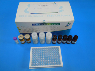 精浆酸性磷酸酶定量测定试剂盒(对硝基酚磷酸法)