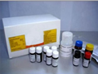 血清铁测定试剂盒(亚铁嗪法)