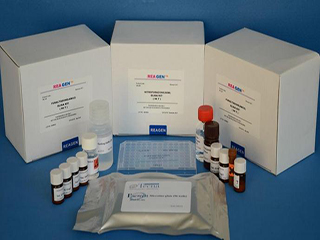 蛋白C活性测定试剂盒(发色底物法)