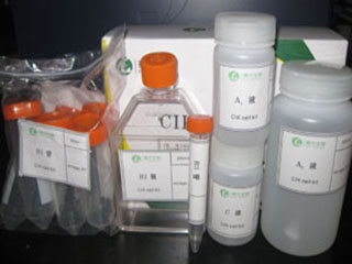 淋巴细胞检测试剂盒