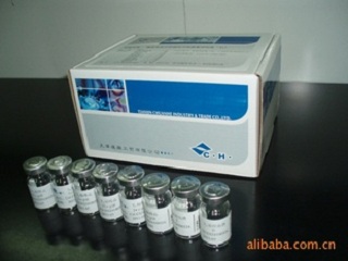 科信 游离甲状腺素(FT4)诊断试剂盒