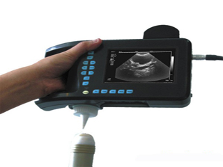 Optigo便携式超声诊断仪
