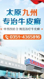 孩子患牛皮癣该怎么办