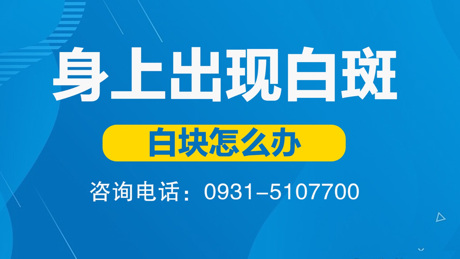 济南白癜风医院哪家好 大面积白癜风该怎么治疗能恢复