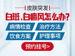 济南白癜风医院 白癜风有哪些典型特征