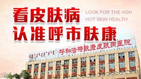 呼和浩特治过敏性荨麻疹去哪里医院