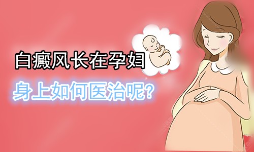 广州去哪家医院治疗白癜风好?孕妇治疗白癜风时要注意什么问题呢