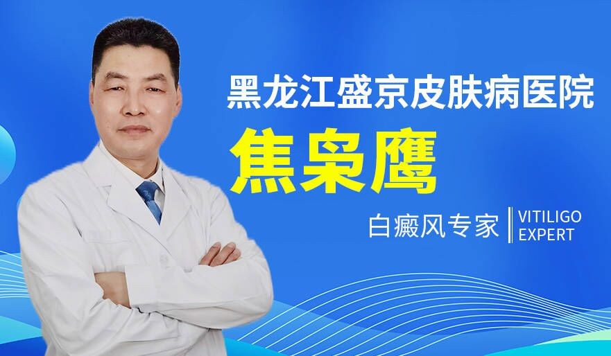 黑龙江盛京皮肤病医院属于公立医院吗-怎么治疗白癜风比较科学