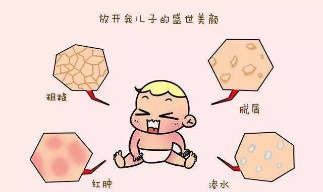 上海治疗皮肤病该注意什么-鱼鳞病生活中需要注意什么