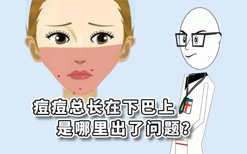 郑州治青春痘比较好的医院-下巴和脑门长痘痘是什么原因?
