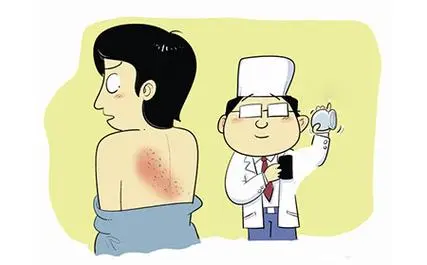 上海看皮肤病专业的医院-体癣会有哪些症状发生