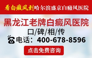 黑龙江盛京皮肤病医院是几等医院-白癜风患者化妆有哪些注意事项