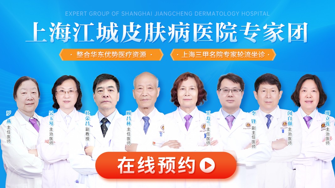 牛皮癣能洗澡吗