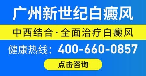 广州白癜风医院口碑怎么样