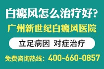 广州哪里有专治疗白癜风医院?白癜风要怎么养生