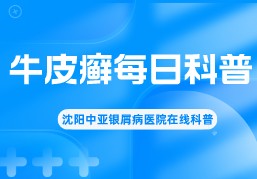 沈阳正规牛皮癣医院”速览名单前十”沈阳看银屑病：牛皮癣发现期的时间探讨