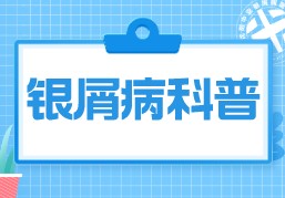 沈阳银屑病治疗医院检查“人气榜” 牛皮癣与头皮屑：不得不说的关系