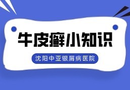 实力盘点：沈阳牛皮癣专科医院“口碑推荐”牛皮癣患者应对失眠的有效方法