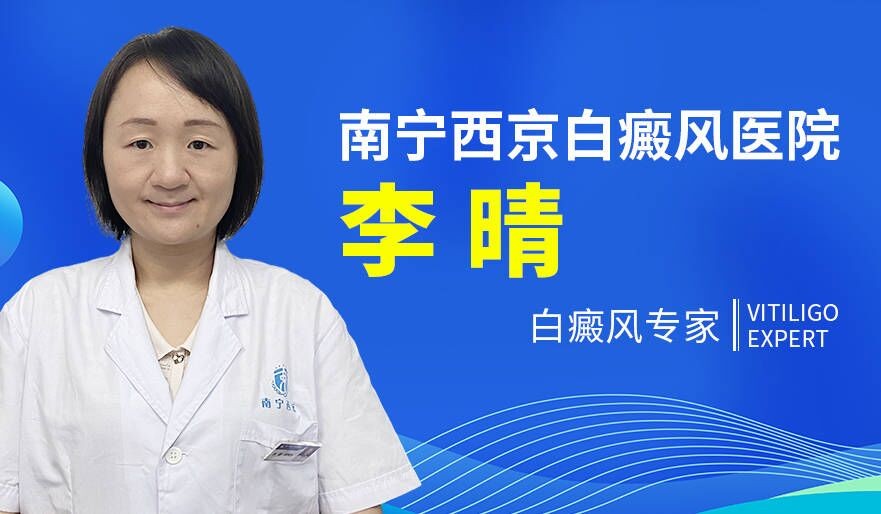 南宁白癜风医院好的是哪家：儿童节段型白癜风怎样预防