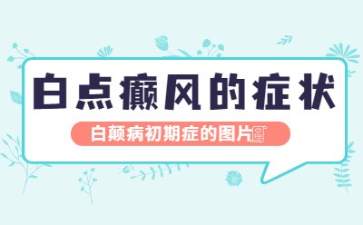 青少年白癜风有什么明显症状-福建博润白癜风治疗专科罗继虎医生