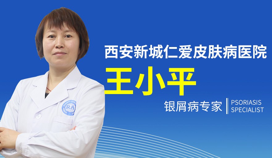 银屑病会传染吗
