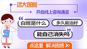 多年的白癜风要如何治疗呢