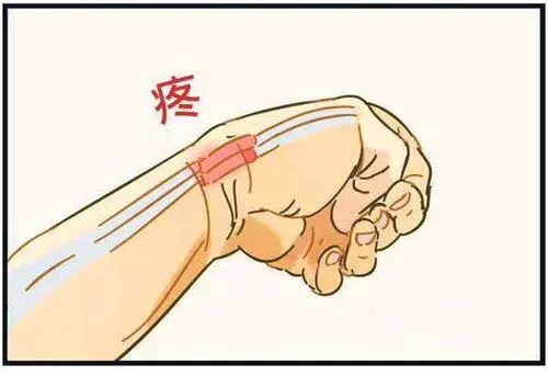 一招自测有无腱鞘炎，这几类人要注意了！