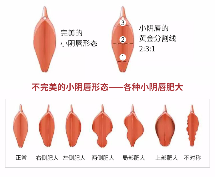私密榜單前十：成都好的治療陰唇整形醫院哪里有？專業陰唇整形醫院推薦成都美容整形醫院私密整形中心！