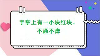 手掌上有一小块红块。不通不痒