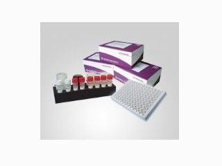 安图绿科 乙型肝炎病毒表面抗体定量检测试剂盒（化学发光法）