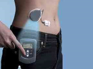 强生 血糖监测系统