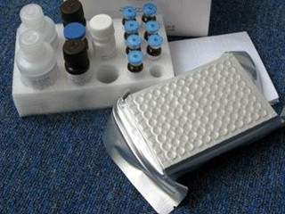 科美 人类免疫缺陷病毒抗原抗体(HIV Ag/Ab)测定试剂盒(化学发光法)