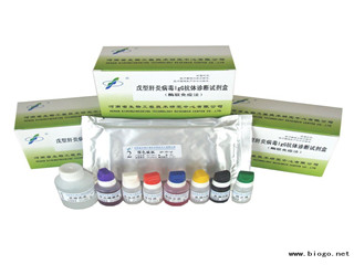 生物工程 戊型肝炎病毒IgG抗体检测试剂盒(酶联免疫法)
