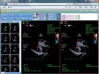 BEION医学图像软件V4.20