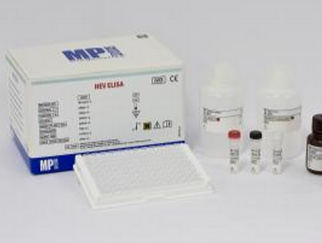 达安基因 乙型肝炎病毒e抗体诊断试剂盒(免疫荧光法)