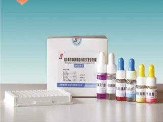 泰德合众 肌酸激酶测定试剂盒(速率法)