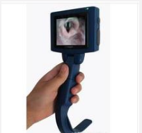 耀远 电子视频喉镜系统