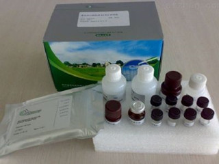 艾杰 单胺氧化酶诊断试剂盒(MAO)