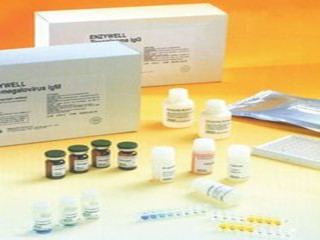 虹业 血管紧张素Ⅱ（ATⅡ）测定试剂盒（增强化学发光法）