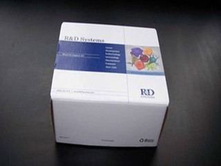 罗氏 弓形虫IgM抗体检测试剂盒(电化学发光法)