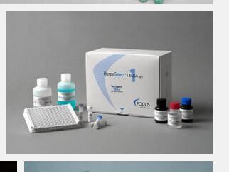 贝尔 麻疹病毒抗体(IgM)检测试剂盒