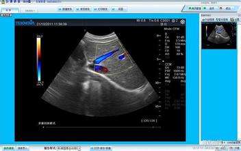 图瑞TR-V医用影像工作站软件V5.0