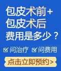 包皮术前+术后费用多少钱