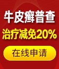 牛皮癣普查治疗减免20%