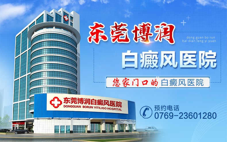 东莞白癜风医院