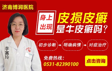 济南博润银屑病医院