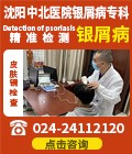 沈阳银屑病医院精准检查银屑病 