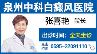 泉州丰泽中科医院女性白癜风科